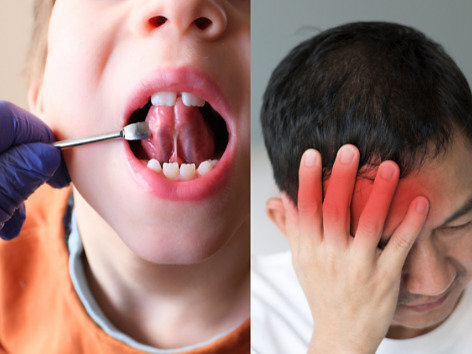 Shutterstock nuotr./ „15min“ fotomontažas/Kalbos atkūrimas po traumos ar insulto