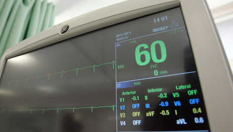 Atidarymo akimirka