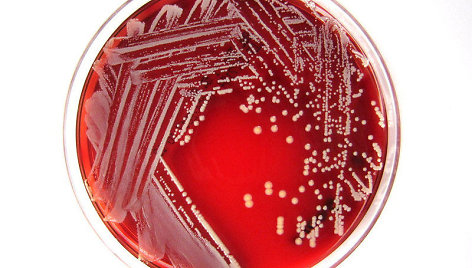 Staphylococcus lugdunensis bakterija