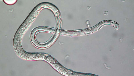 Strongyloides stercoralis, mastelio žymeklio dydis &ndash; 30 mikrometrų