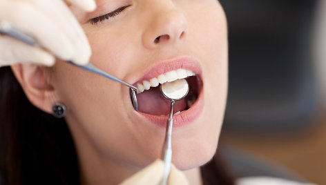 Specialios balinančios dantų pastos  gali pašviesinti jūsų dantis, bet jei norite geresnio efekto, kreipkitės į odontologą.