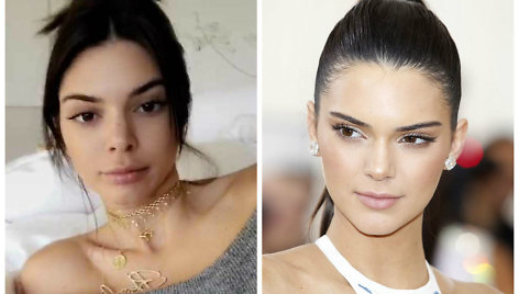 Kendall Jenner dabar ir anksčiau