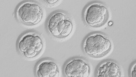 Besivystantys žmogaus embrionai, kuriuose panaudota DNR i&scaron; odos ląstelių, trečiąją vystymosi dieną. 