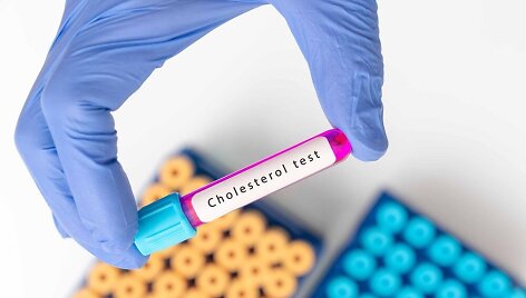 Cholesterolis
