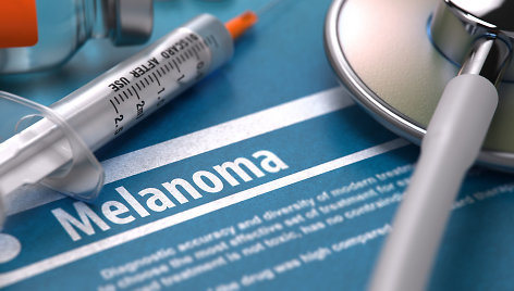 Odos vėžys – itin grėsminga liga.