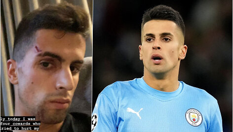 Joao Cancelo buvo apiplė&scaron;tas ir sužeistas