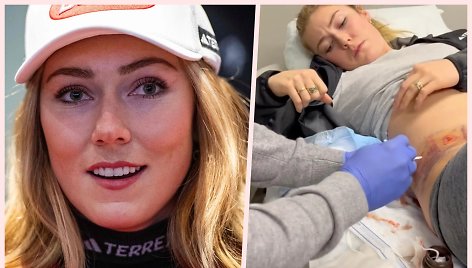 Mikaela Shiffrin susižeidė per kalnų slidinėjimo pasaulio taurės varžybas JAV.