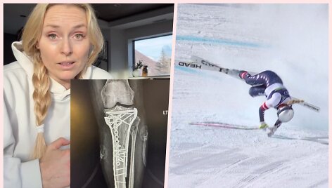 Lindsey Vonn sveiksta po siaubingo kritimo Milano-Kortinos žaidynėse.