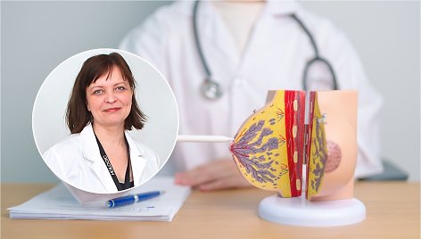 Krūties vėžys – dažniausia moterims nustatoma onkologinė liga / dr. R.Briedienė