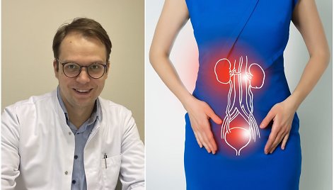 Gydytojas urologas Arnoldas Zabarskas – apie šlapimo pūslės uždegimą