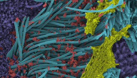 SARS-CoV-2 virionai atakuoja plaučių ląsteles