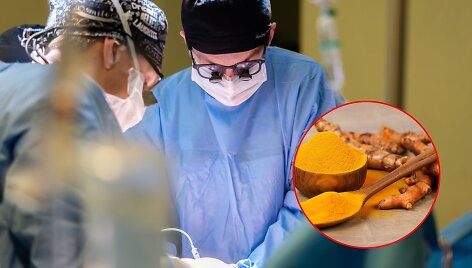 Kepenų transplantacija