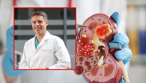 Jelenai viltį suteikė Lietuvoje pirmą kartą pritaikytas metodas