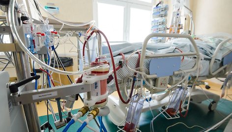 Santaros klinikų Reanimacijos ir intensyvios terapijos skyrius