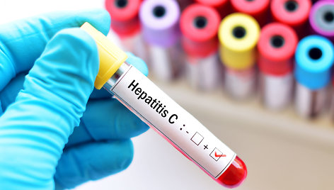 Hepatito C tyrimai