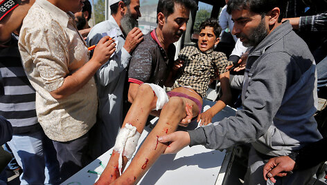 Per granatos sprogimą Ka&scaron;myre sužeistas paauglys