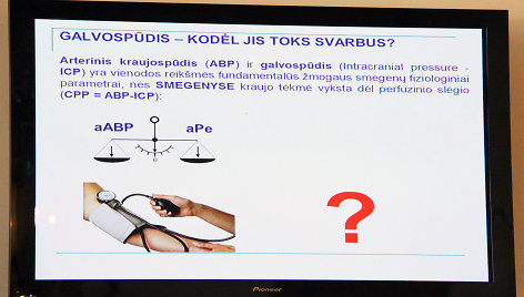 Galvospūdis - kodėl jis toks svarbus