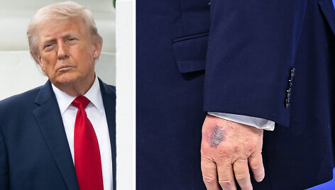 Donaldas Trumpas
