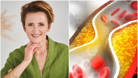 Dietistė Raminta Bogušienė apie tai, kaip suvaldyti cholesterolį