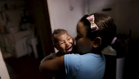 Brazilijoje dėl Zika viruso mikrocefalija sergantis kūdikis