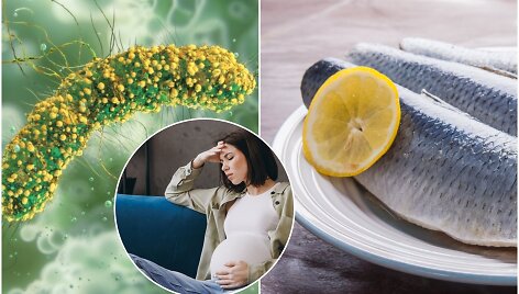 Listeria monocytogenes sukeliama infekcija ypač pavojinga nė&scaron;čiosioms ir naujagimiams