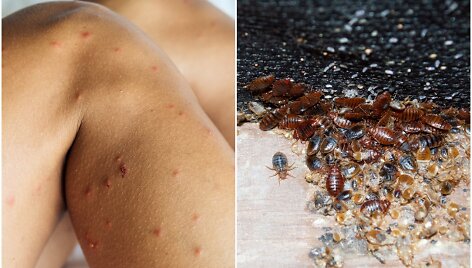 Lietuvių pamėgtas miestas paskelbtas &bdquo;Europos patalinių blakių sostine&ldquo;