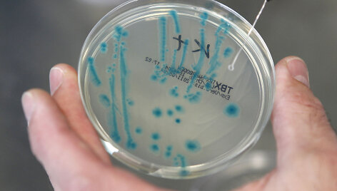 E.coli bakterijos tyrimai