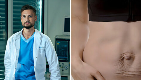 &bdquo;Nordclinic&ldquo; plastikos chirurgas Aurimas Dobilinskas