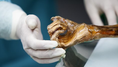 Italijos mokslininkai atlieka tyrimus su Oetzi, 5300 metų senumo mumija