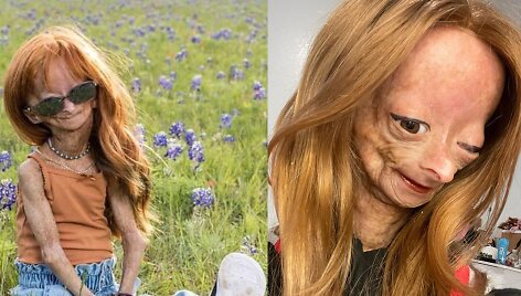 Adalia Rose