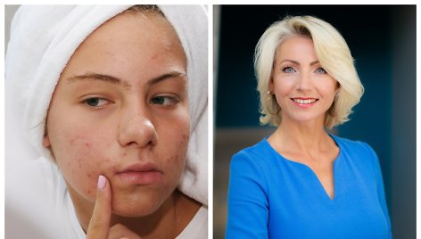 Dermatologė Asta Dumbliauskienė ir asociatyvi nuotr.