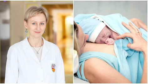 Gydytoja aku&scaron;erė ginekologė doc. dr. Gitana Ramonienė pasakoja apie CPO indikacijas, skubumą ir eigos ypatumus