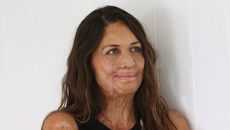 Turia Pitt