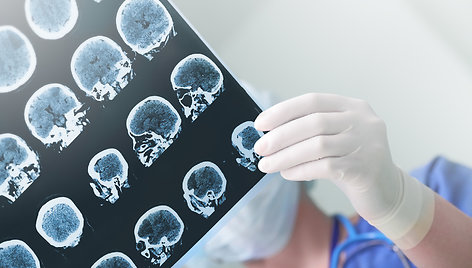 Dirbtinis intelektas žmonių rasę gali nuspėti iš rentgeno nuotraukų