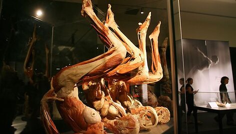 Prie&scaron;taringai vertinamas vokiečių medikas konservuoja lavonus ir i&scaron; jų kuria skulptūras.