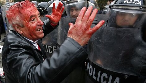 Protesto akcija Tiranoje virto kruvinomis kautynėmis.