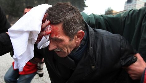 Protesto akcija Tiranoje virto kruvinomis kautynėmis.
