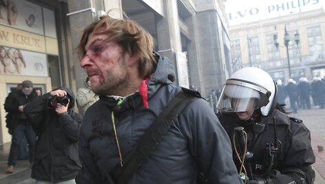 Sužeistas demonstrantas