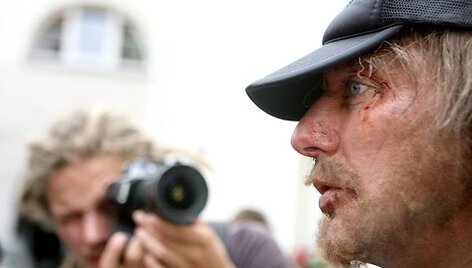 Sunkiai atpažįstamas verslininkas Marius Gelažnikas