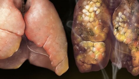 JAV administracijos siūlomos nuotraukos cigarečių pakeliams
