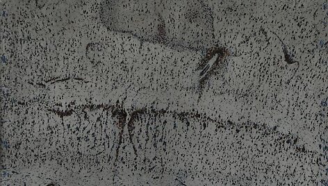 Galerijos startas skelbiamas Beno &Scaron;arkos paroda &bdquo;Rojus smegenų žievės peizažuose&ldquo;. 