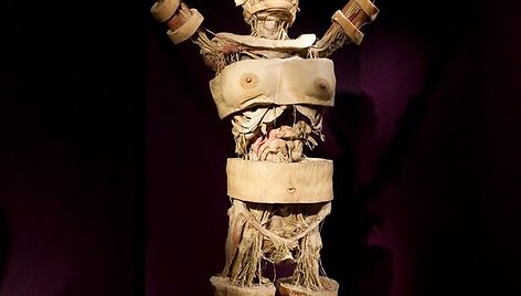 Parodos &bdquo;The Human Body Exhibition&ldquo; eksponatas