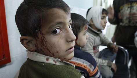 Sužeisti palestinos vaikai