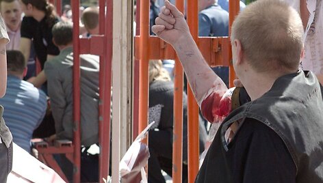 Sužeistas vyras laukia greitosios.