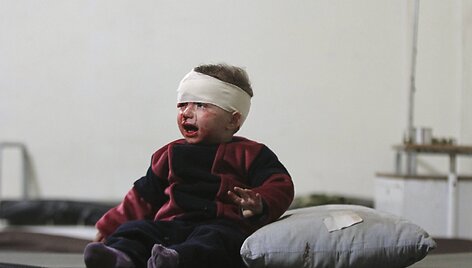 Damaske per raketų sprogimus sužeistas berniukas