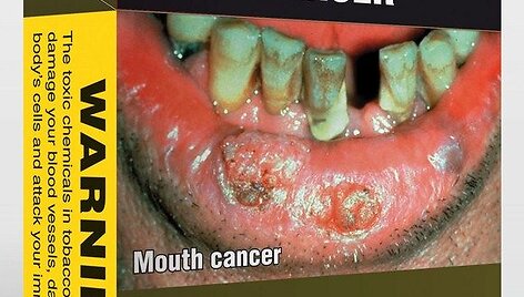 Australijoje pardavinėjami cigarečių pakeliai su perspėjimu &bdquo;Rūkymas sukelia burnos ir gerklės vėžį&ldquo;