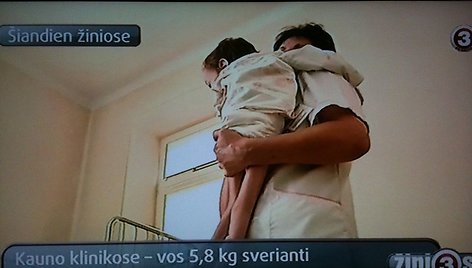 Kauno medikams atvežta septynmetė nesvėrė nė šešių kilogramų