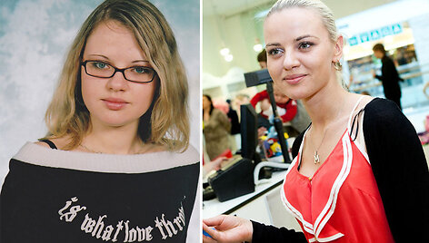 Renata Uzialkaitė &ndash; anksčiau ir dabar