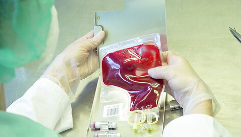 Dažniausiai negrįžtamai kepenis sužalojantis hepatito C virusas pramintas &bdquo;tyliuoju žudiku&ldquo;. 