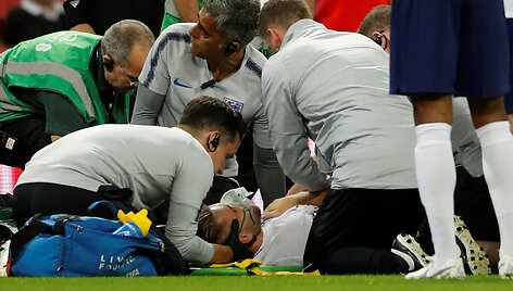 Skausminga Luke'o Shaw trauma 